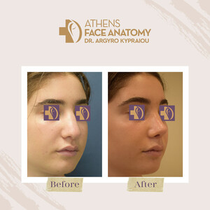 Image of Athens Face Anatomy - Dr. Argyro Kypraiou Gallery 0