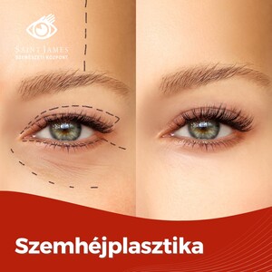 Image of Eye care