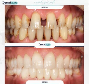 Image of Before and After Image