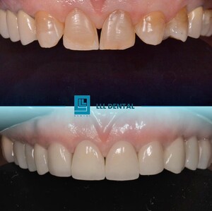 Image of Smile Makeover - LLL Dental