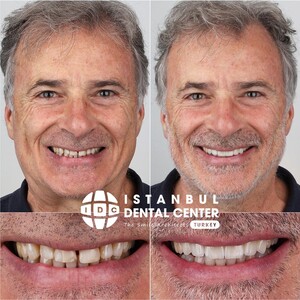 Image of Istanbul Dental Center Gallery 2