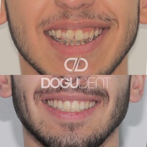 Image of DoğuDent Dental Clinic Gallery 1