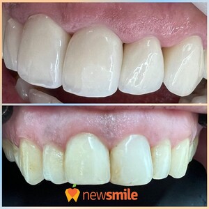 Image of New Smile Dental Clinic Gallery 1