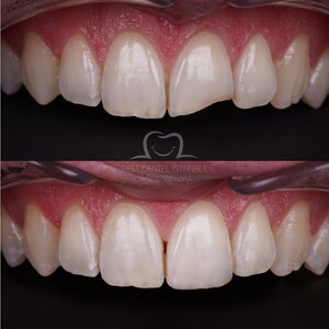 Image of Best Dental Istanbul Gallery 3