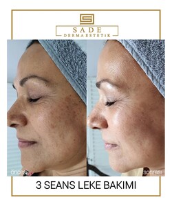 Image of Sade Derma Aesthetic Gallery 2