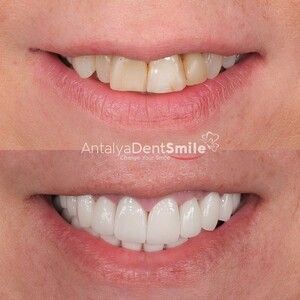 Image of Antalya Dent Smile Gallery 1