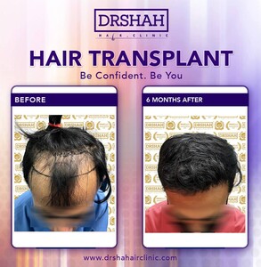 Image of Dr Shah Specialist Hair Loss Clinic Gallery 2