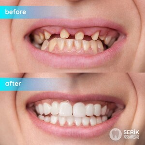 Image of Private Serik Oral and Dental Health Policlinic Gallery 3