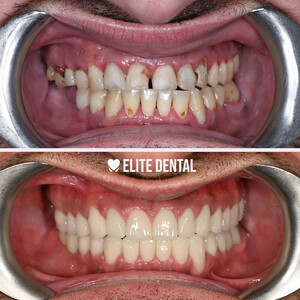 Image of Dentista Albania - Elite Dental Gallery 1