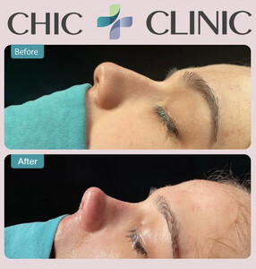 Image of Chic Clinic Istanbul Gallery 3