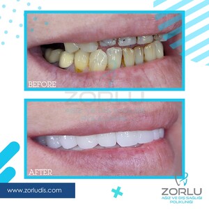 Image of Zorlu Oral and Dental Health Center Gallery 2