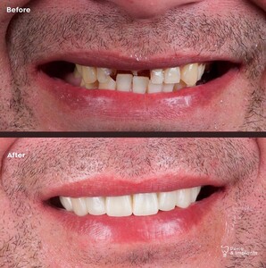 Image of Smile makeover