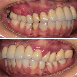 Image of Dental treatment