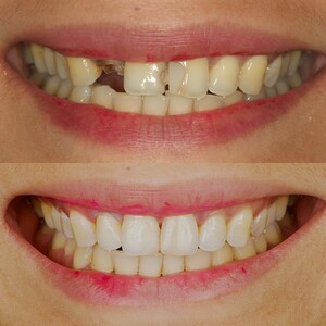 Image of Tooth Booth Dental Clinic Gallery 2