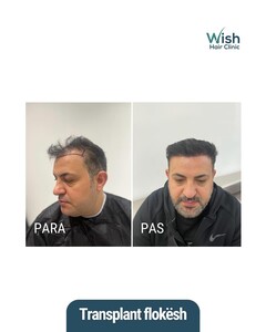 Image of Wish Hair Clinic Gallery 1