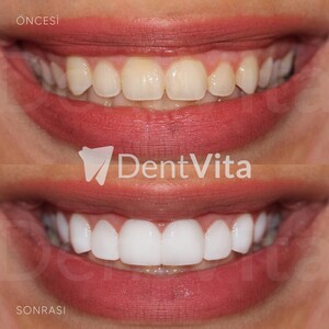 Image of DentVita Dental Clinic Gallery 3