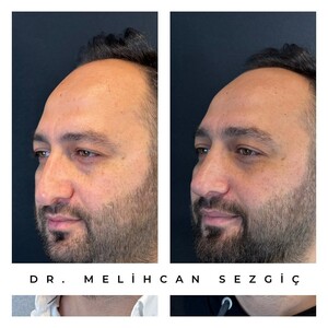 Image of MD.Melih Can Sezgiç Gallery 3