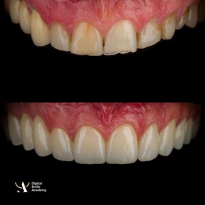 Image of Smile makeover