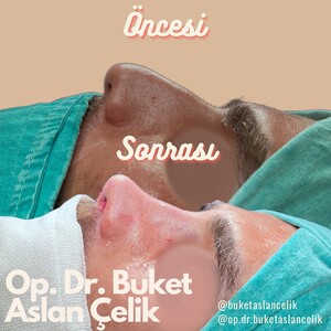 Image of Op. Dr. Buket Aslan Çelik Clinic Gallery 0