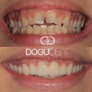 Image of DoğuDent Dental Clinic Gallery 0