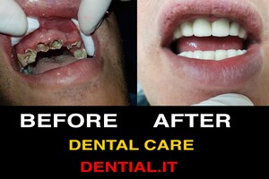 Image of Dential Dental Care Gallery 0