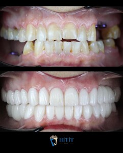 Image of Hitit Dental Gallery 1