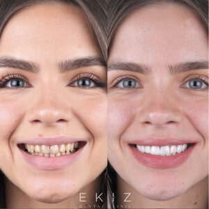 Image of Ekiz Dental Clinic Gallery 3