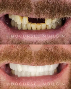 Image of Pro Estetik Dental Clinic - Selim Bilgin Gallery 1