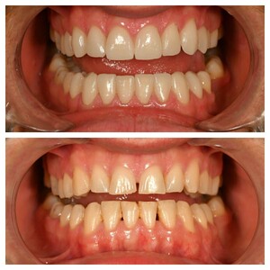 Image of Smile makeover