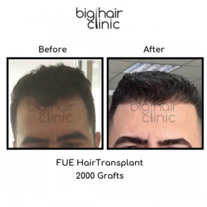 Image of Big Hair Clinic Gallery 2