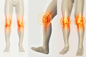 Image of Knee pain treatment