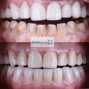 Image of Positive Dental Studio Gallery 1