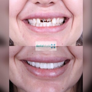 Image of Positive Dental Studio Gallery 3