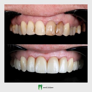 Image of Dental treatment - Warsaw Dental Academy