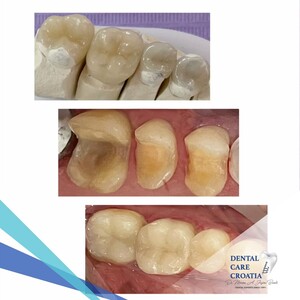 Image of Dental Care Croatia Gallery 2