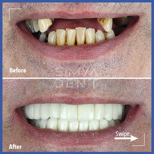 Image of SimyaDent Dental Clinic Gallery 3