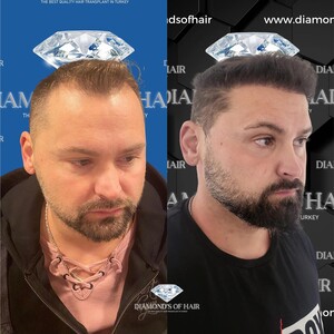 Image of Diamond's of Hair Gallery 2